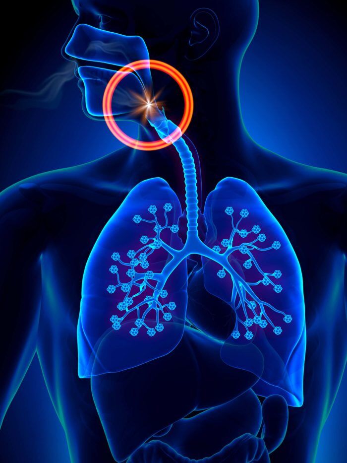 graphic of body depicting sleep apnea
