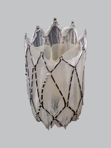 ‘First of its kind’ pulmonary valve ‘grows’ with patients