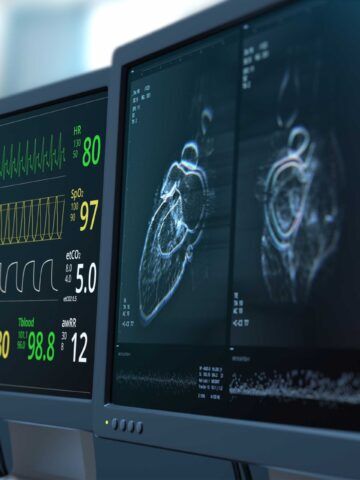 CHOC-led study explores cardiac MRI for borderline left ventricle surgery