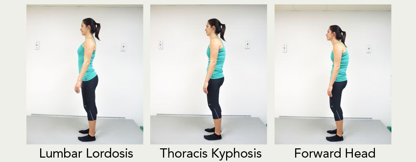 Bad-Standing-Posture