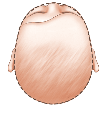 baby head shape normal
