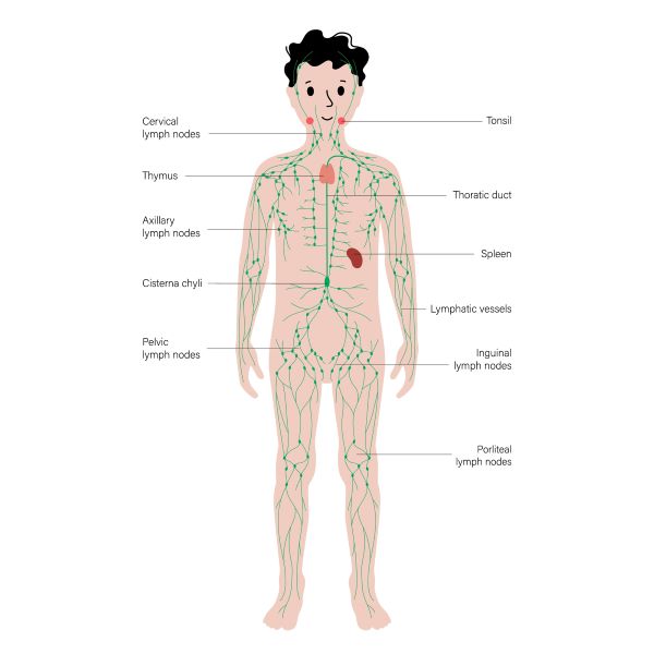 Lymphatic Malformations - Children's Hospital of Orange County